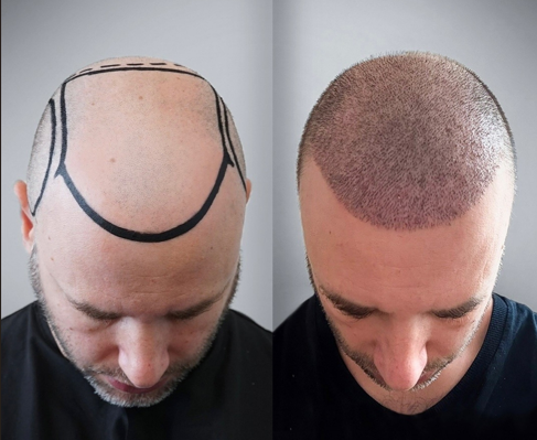 ekran görüntüsü 2025 10 15 151435