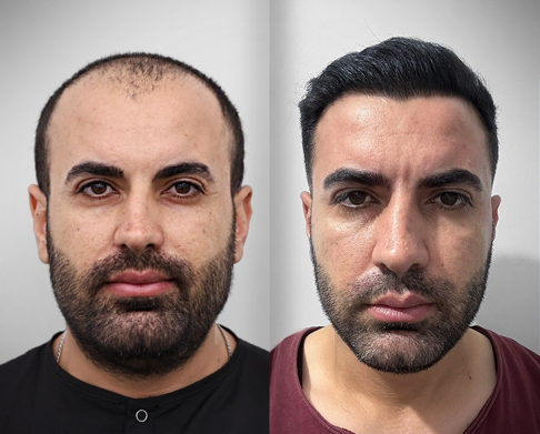 ekran görüntüsü 2025 10 20 161431